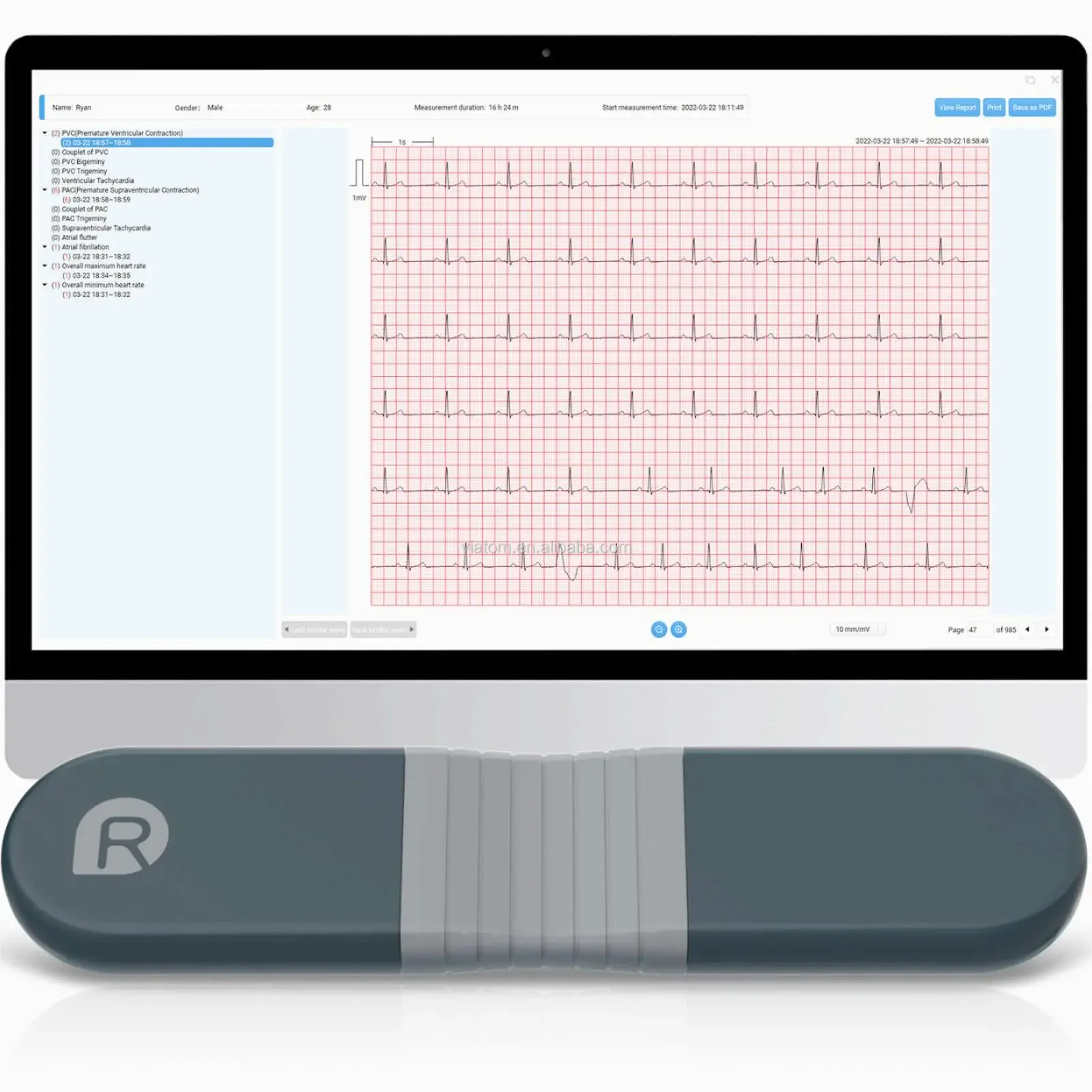سماعة لاسلكية تعمل بالبلوتوث م - مراجعة Ecg Patch Monitor وسعره